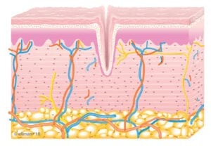 skin1
