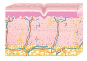 skin3